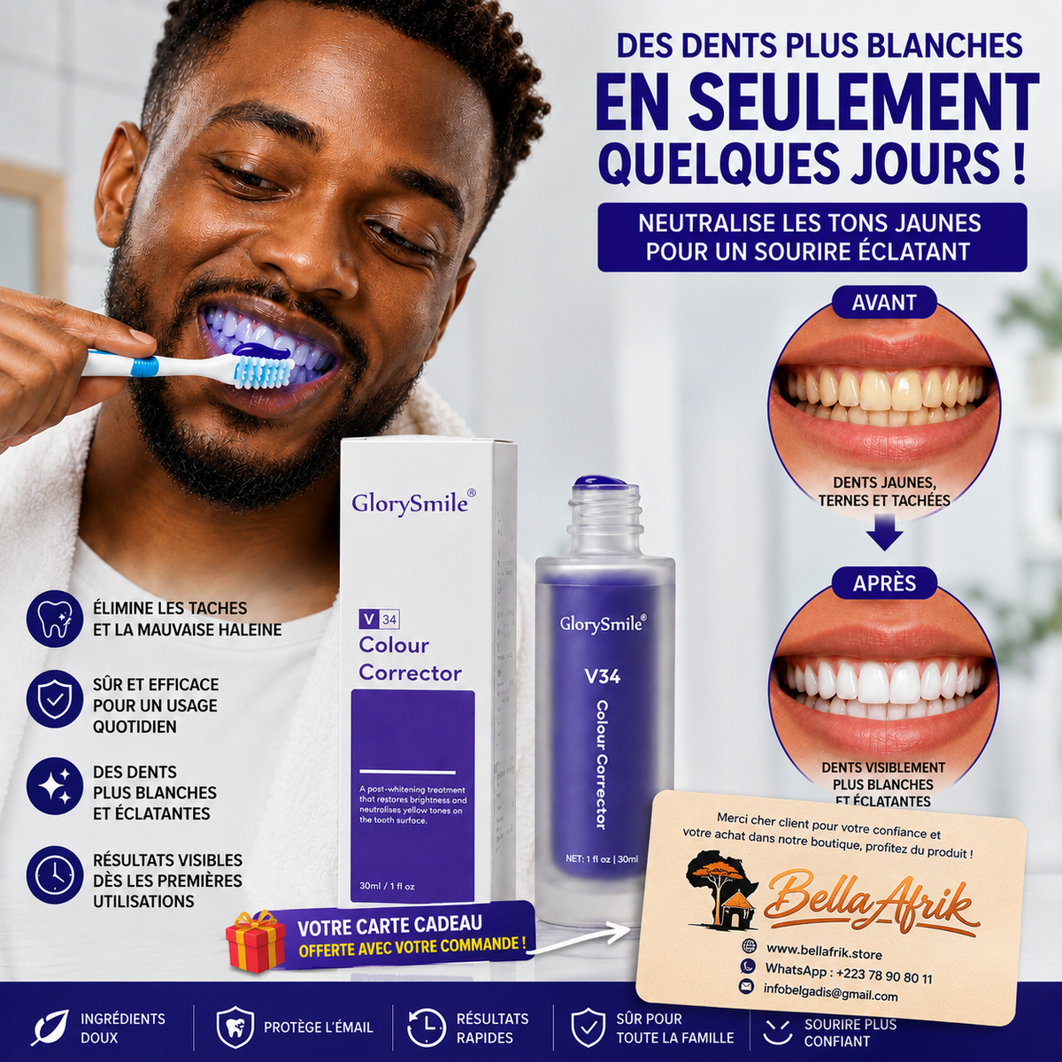 Blanchiment Dentaire™️ Sourire Éclatant