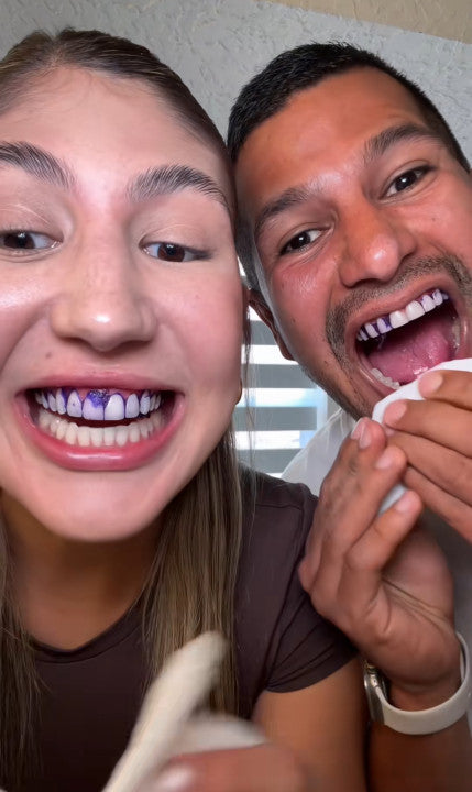 Blanchiment Dentaire™️ Sourire Éclatant