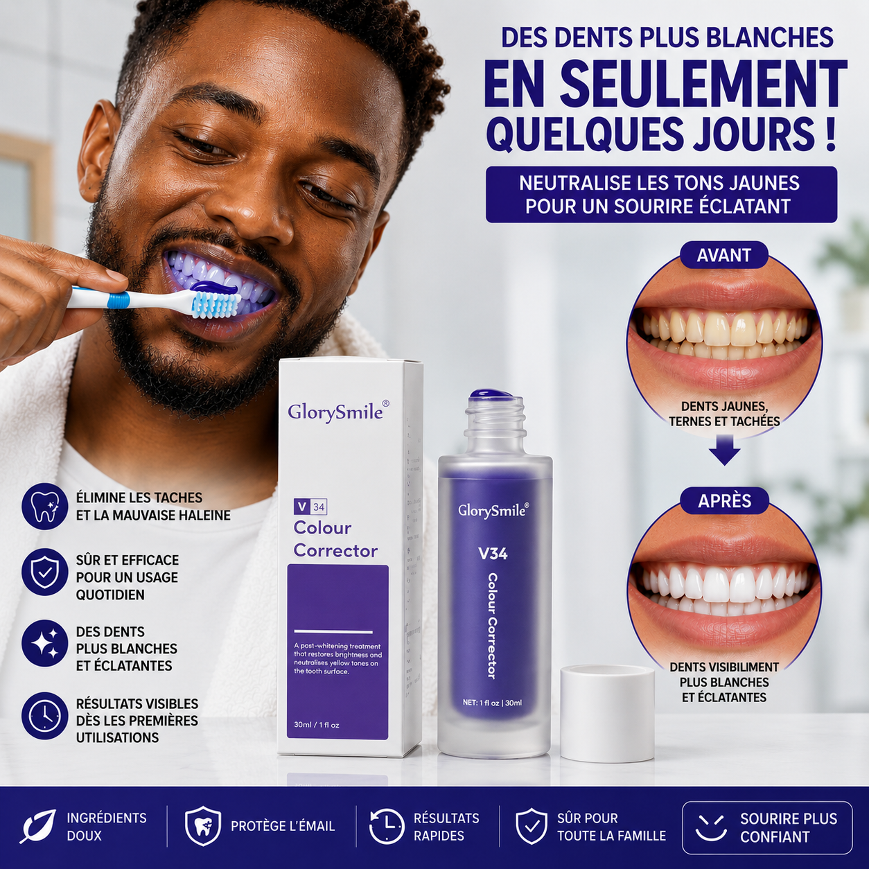 Blanchiment Dentaire™️ Sourire Éclatant